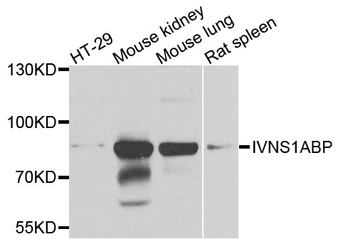 Western blot - IVNS1ABP Polyclonal Antibody 