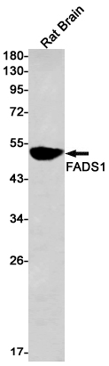 Western blot detection of FADS1 in Rat Brain lysates using FADS1 Rabbit mAb(1:1000 diluted).Predicted band size:52kDa.Observed band size:52kDa.