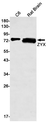 Western blot detection of ZYX in C6,Rat Brain lysates using ZYX Rabbit mAb(1:500 diluted).Predicted band size:61kDa.Observed band size:78kDa.