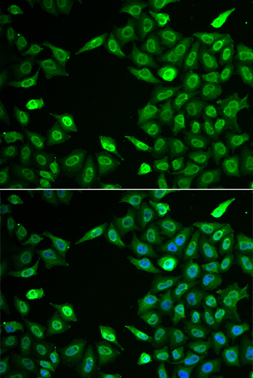 Immunofluorescence - INTS6 Polyclonal Antibody 