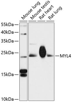 Western blot - MYL4 Polyclonal Antibody 