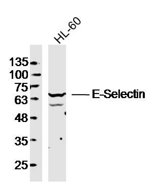 Fig1: Sample: HL-60 Cell (Human) Lysate at 40 ug; Primary: Anti- E-Selectin at 1/300 dilution; Secondary: IRDye800CW Goat Anti-Rabbit IgG at 1/20000 dilution; Predicted band size: 65 kD; Observed band size: 65 kD