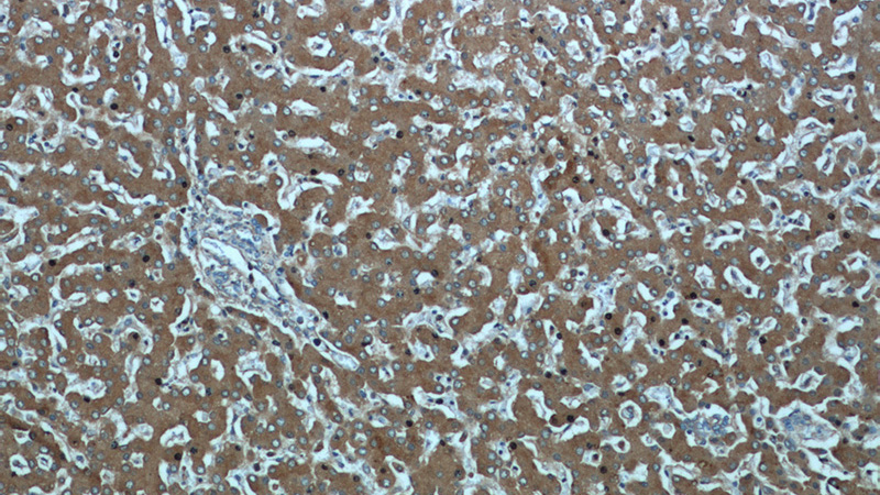 Immunohistochemical of paraffin-embedded human liver using Catalog No:115331(SLC25A25 antibody) at dilution of 1:50 (under 10x lens)