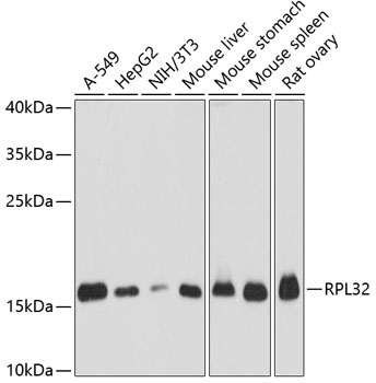 Western blot - RPL32 Polyclonal Antibody 
