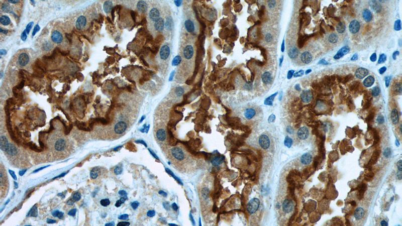 Immunohistochemistry of paraffin-embedded human kidney tissue slide using Catalog No:114704(RIMBP2 Antibody) at dilution of 1:50 (under 40x lens)