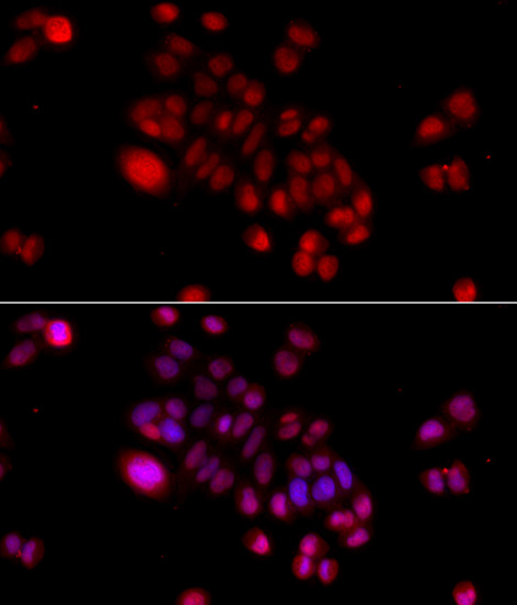 Immunofluorescence - DNAJB6 Polyclonal Antibody 