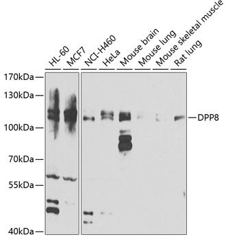 Western blot - DPP8 Polyclonal Antibody 