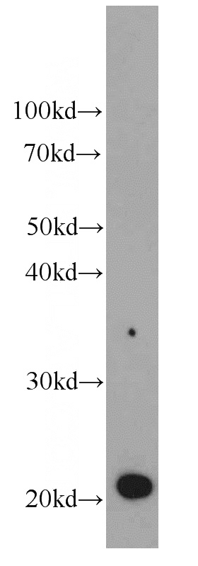 HeLa cells were subjected to SDS PAGE followed by western blot with Catalog No:107302(GM2A antibody) at dilution of 1:500