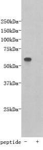 Fig1: Western blot analysis on D3 using anti- TMEM132E polyclonal antibody.