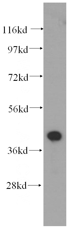 human liver tissue were subjected to SDS PAGE followed by western blot with Catalog No:113597(PARVA antibody) at dilution of 1:500