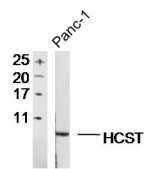 Fig1: Sample:; Panc-1 Cell (Human) Lysate at 30 ug; Primary: Anti- HCST at 1/300 dilution; Secondary: IRDye800CW Goat Anti-Rabbit IgG at 1/20000 dilution; Predicted band size: 8kD; Observed band size: 8kD