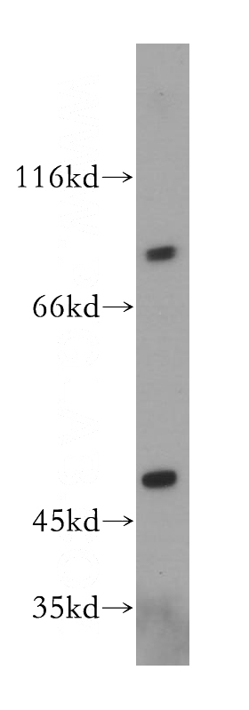 PC-3 cells were subjected to SDS PAGE followed by western blot with Catalog No:108262(ARHGAP18 antibody) at dilution of 1:400