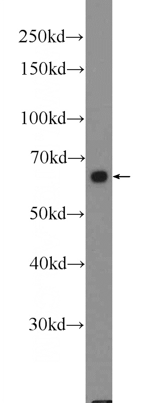 COLO 320 cells were subjected to SDS PAGE followed by western blot with Catalog No:110760(FZD5 Antibody) at dilution of 1:600