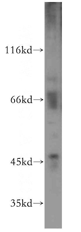 mouse brain tissue were subjected to SDS PAGE followed by western blot with Catalog No:110087(DNAJA4 antibody) at dilution of 1:500