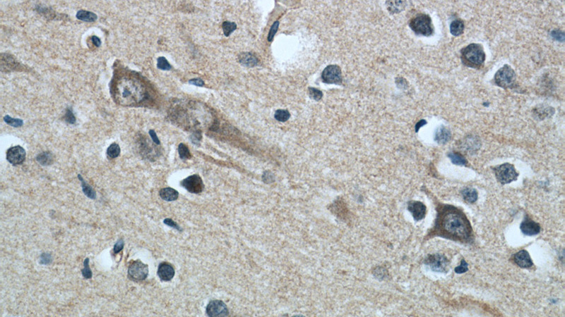 Immunohistochemistry of paraffin-embedded human brain tissue slide using Catalog No:109712(CYP7B1 Antibody) at dilution of 1:50 (under 40x lens)