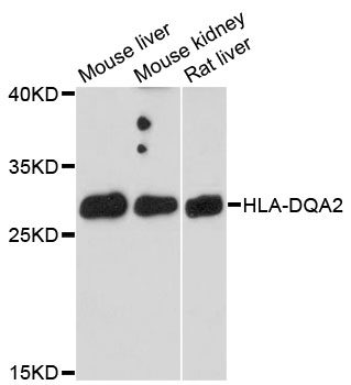 Western blot - HLA-DQA2 Polyclonal Antibody 
