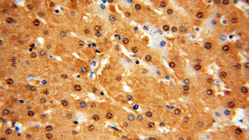 Immunohistochemical of paraffin-embedded human liver using Catalog No:110913(GCOM1 antibody) at dilution of 1:100 (under 40x lens)