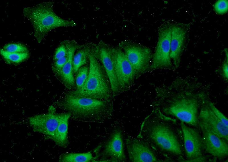 Immunofluorescent analysis of A549 cells using Catalog No:111799(INHBA Antibody) at dilution of 1:50 and Alexa Fluor 488-congugated AffiniPure Goat Anti-Rabbit IgG(H+L)