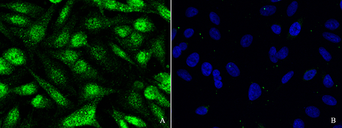 SOCS1 Antibody, Rabbit PAb, Antigen Affinity Purified, Immunofluorescence