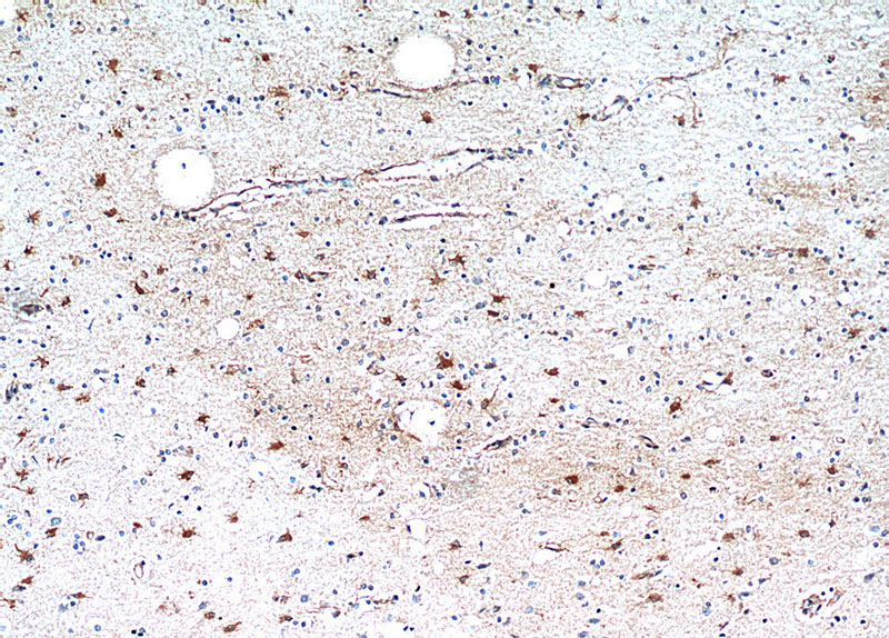 Immunohistochemical of paraffin-embedded human brain using Catalog No:114993(SCGBL antibody) at dilution of 1:50 (under 10x lens)