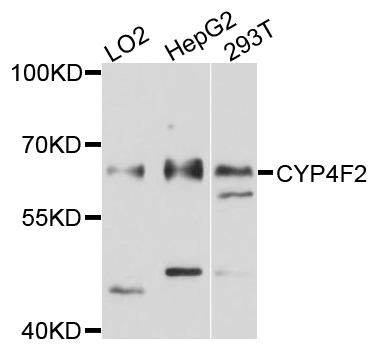 Western blot - CYP4F2 Polyclonal Antibody 