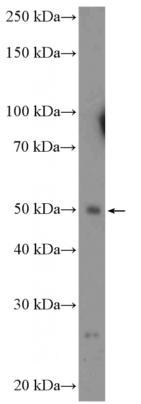 K-562 cells were subjected to SDS PAGE followed by western blot with Catalog No:115607(SSH2 Antibody) at dilution of 1:300