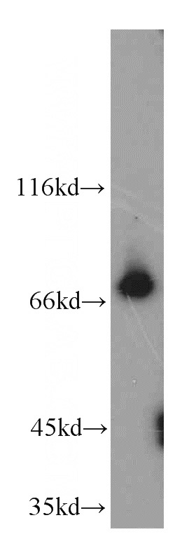 Jurkat cells were subjected to SDS PAGE followed by western blot with Catalog No:108992(CCDC93 antibody) at dilution of 1:500