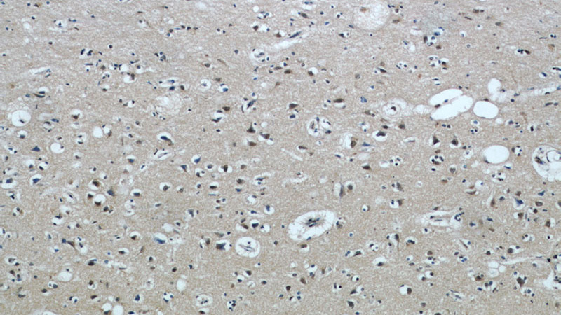 Immunohistochemical of paraffin-embedded human brain using Catalog No:115903(TCERG1 antibody) at dilution of 1:50 (under 10x lens)