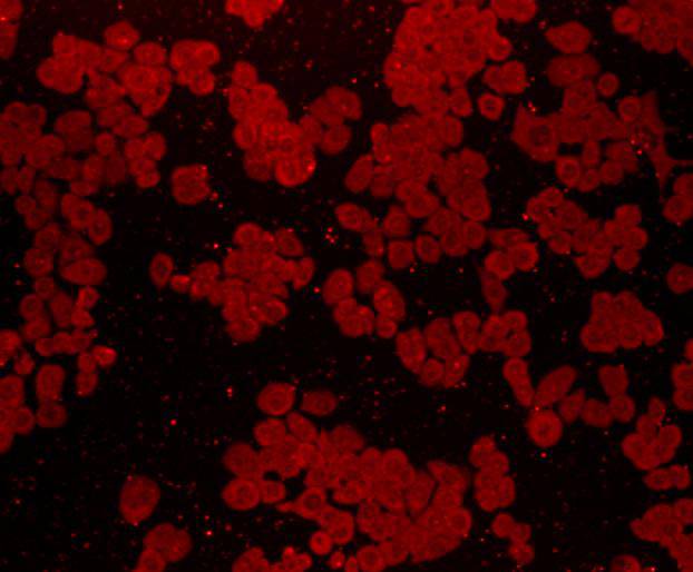 Fig3: ICC staining of FGFR2 in Ags cells (red). Cells were fixed in paraformaldehyde, permeabilised with 0.25% Triton X100/PBS.