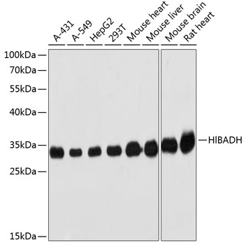 Western blot - HIBADH Polyclonal Antibody 