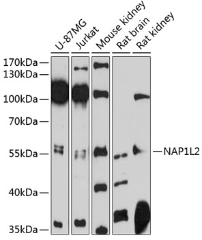 Western blot - NAP1L2 Polyclonal Antibody 