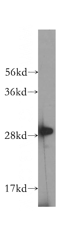 human brain tissue were subjected to SDS PAGE followed by western blot with Catalog No:114404(RAB10 antibody) at dilution of 1:400