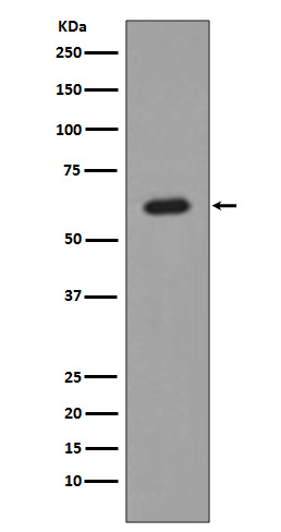 Western blot analysis of AKT1 expression in MCF-7 cell lysate.