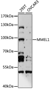 Western blot - MMEL1 Polyclonal Antibody 