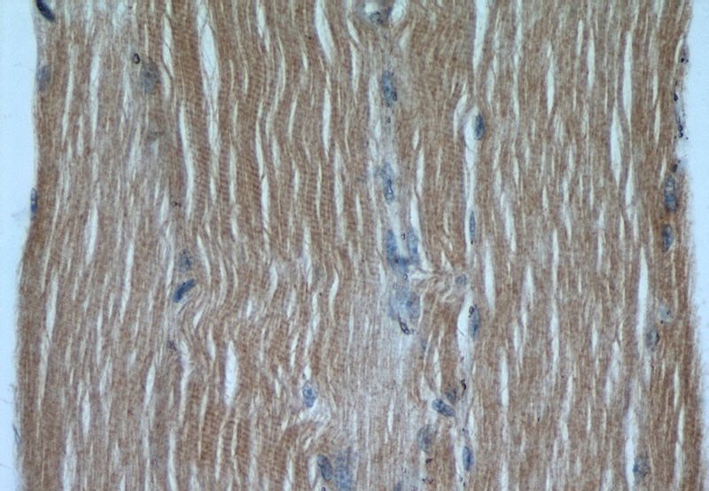Immunohistochemical of paraffin-embedded human skeletal muscle using Catalog No:117305(ACTB antibody) at dilution of 1:100 (under 40x lens)