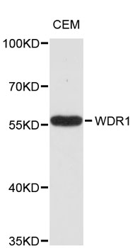 Western blot - WDR1 Polyclonal Antibody 