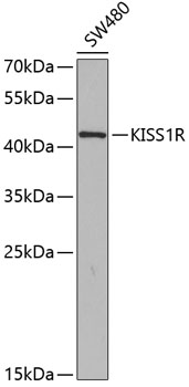 Western blot - KISS1R Polyclonal Antibody 