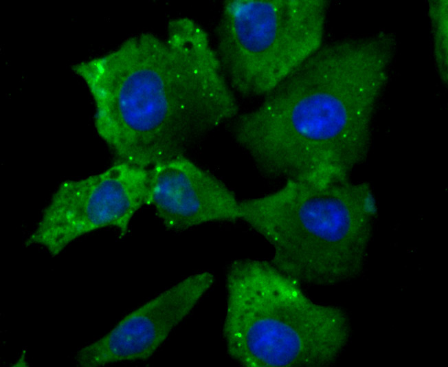 Fig1: ICC staining NaV1.7 (green) in A549 cells. The nuclear counter stain is DAPI (blue). Cells were fixed in paraformaldehyde, permeabilised with 0.25% Triton X100/PBS.