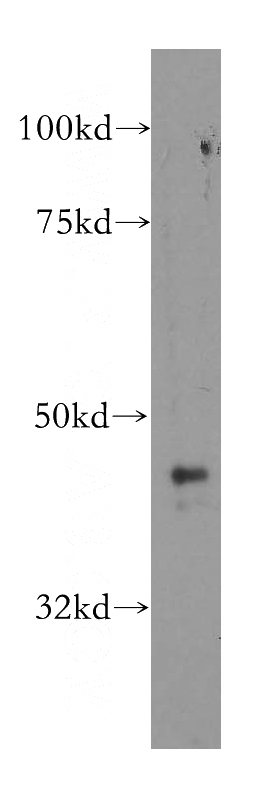PC-3 cells were subjected to SDS PAGE followed by western blot with Catalog No:108250(ARFGAP1 antibody) at dilution of 1:400