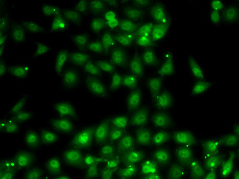 Immunofluorescence - MBNL1 Polyclonal Antibody 