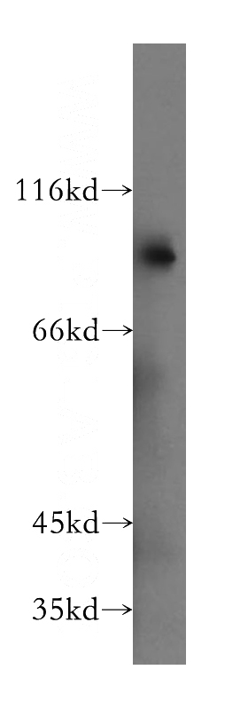 HEK-293 cells were subjected to SDS PAGE followed by western blot with Catalog No:115376(SLC3A1 antibody) at dilution of 1:800