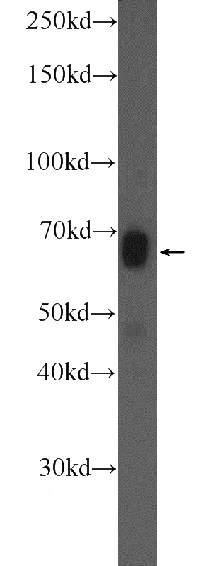 mouse kidney tissue were subjected to SDS PAGE followed by western blot with Catalog No:113507(OPN, SPP1 Antibody) at dilution of 1:600