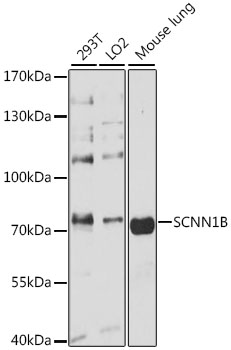 Western blot - SCNN1B Polyclonal Antibody 