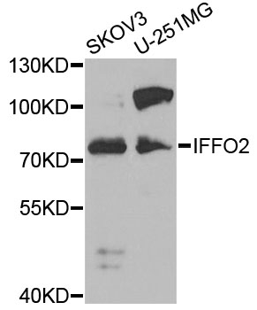 Western blot - IFFO2 Polyclonal Antibody 