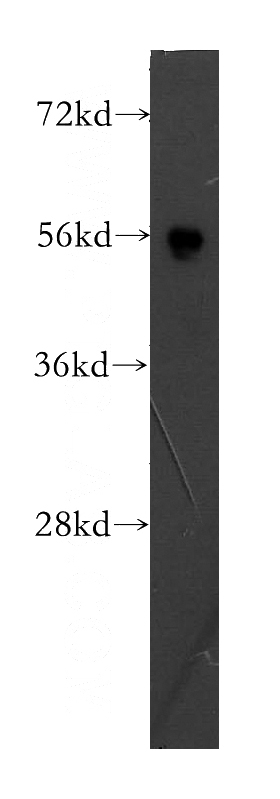 Jurkat cells were subjected to SDS PAGE followed by western blot with Catalog No:115240(SIRPG antibody) at dilution of 1:400