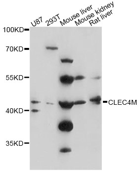 Western blot - CLEC4M Polyclonal Antibody 