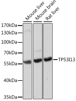 Western blot - TP53I13 Polyclonal Antibody 
