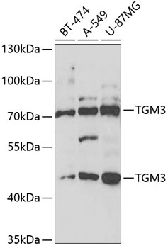 Western blot - TGM3 Polyclonal Antibody 