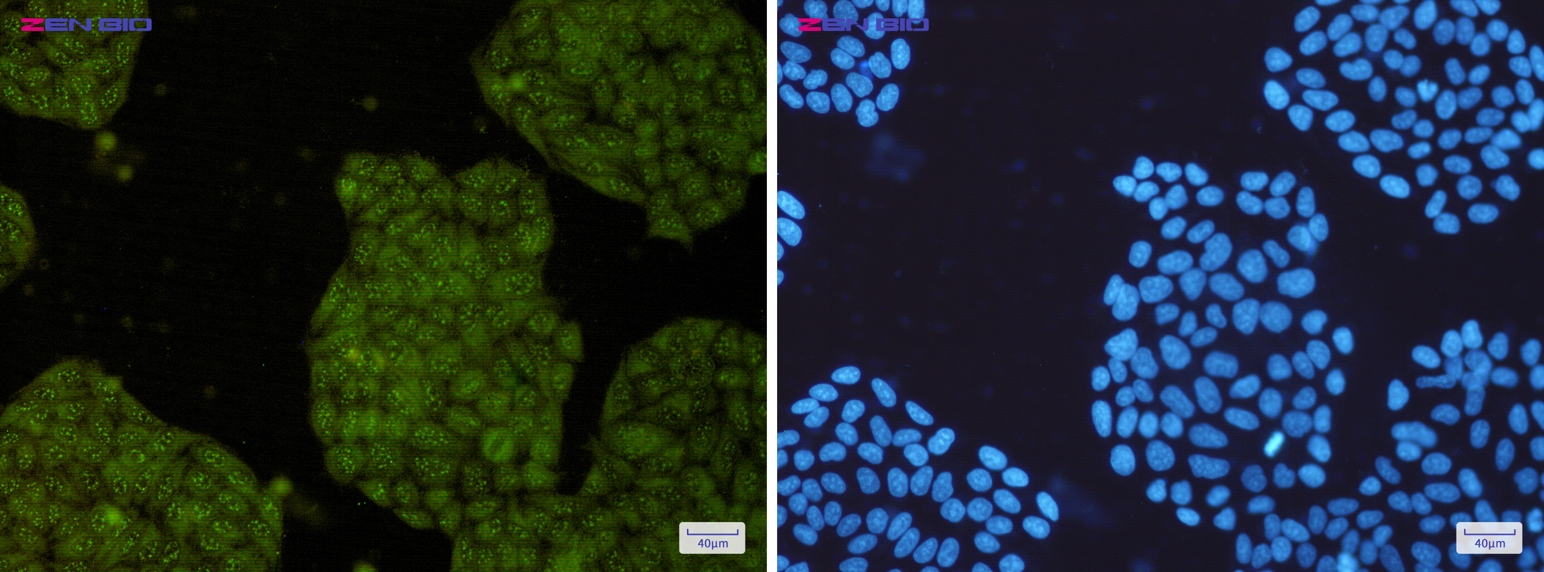 Immunocytochemistry of UFC1(green) in Hela cells using UFC1 Rabbit mAb at dilution 1/200, and DAPI(blue)