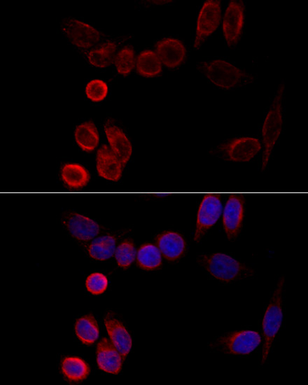 Immunofluorescence - CYP2A6 Polyclonal Antibody 